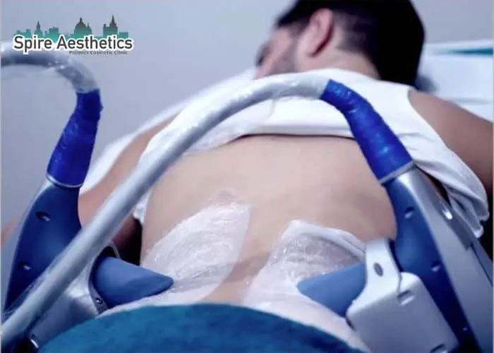 Man having fat freezing treatment done on love handles before a competitions Barnet to create a sculpted look.