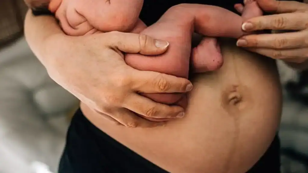 Why Is My Stomach Still Big After Pregnancy Barnet?